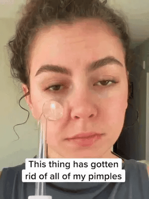 High Frequency Skin Care & Hair Growth Wand